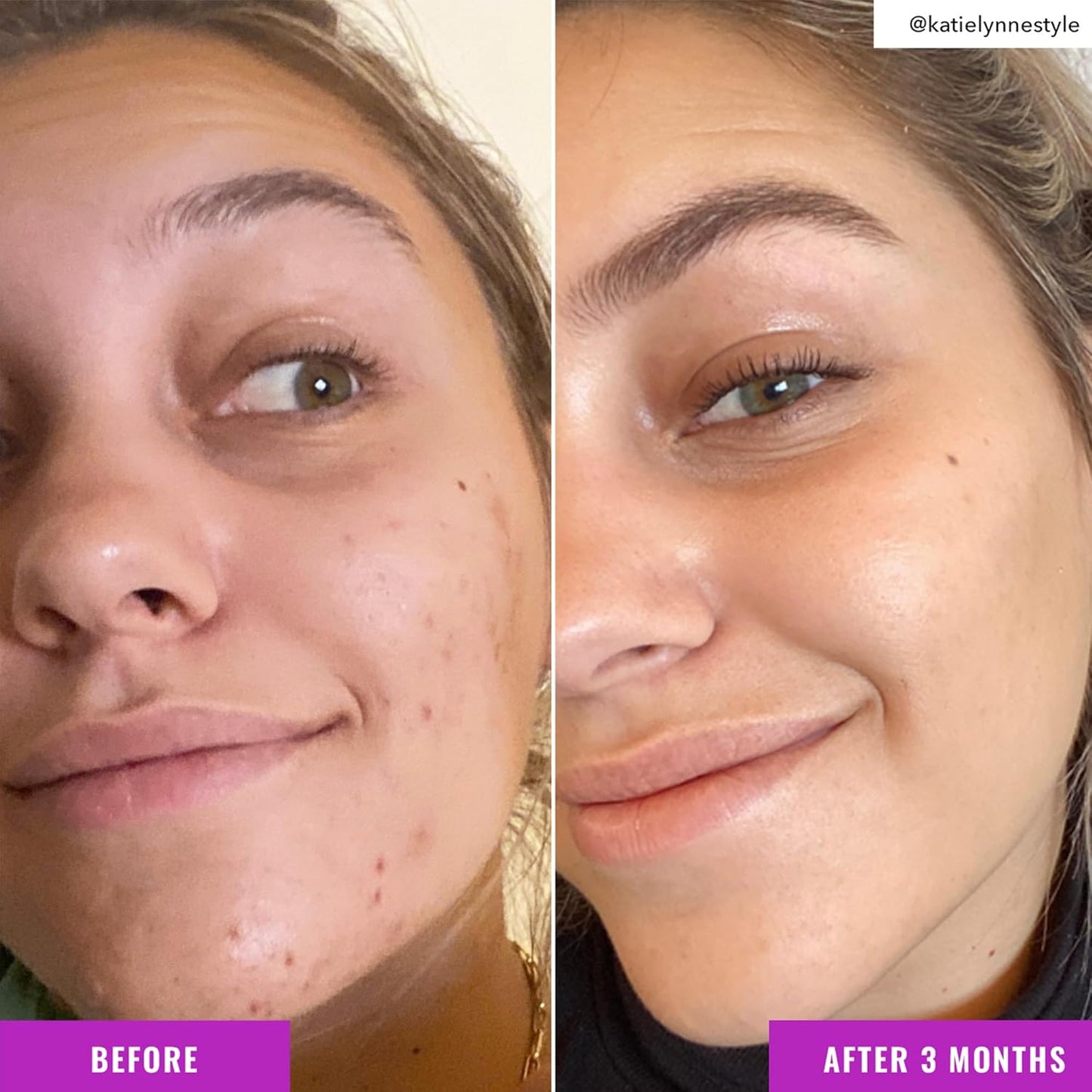 Good Molecules Niacinamide Brightening Toner - Toner for Face with Niacinamide and Arbutin for Skin Tone Balancing- Pore Minimizer, Skin Care for Face