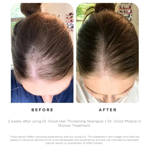 Dr. Groot Hair Thickening Shampoo, Korean Hair Care with Biotin, Rosemary Oil to Help Volumize Thinning, Damaged Hair, Hydrate Hair and Scalp, Biotin Shampoo, Scalp Revitalizing Solution