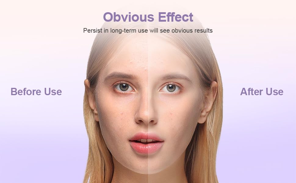 Facial Roller for Puffy Eyes, Ice Globes for Face 360° Rotating Eye Cream Applicator Tool Ice Roller for Face and Eyes