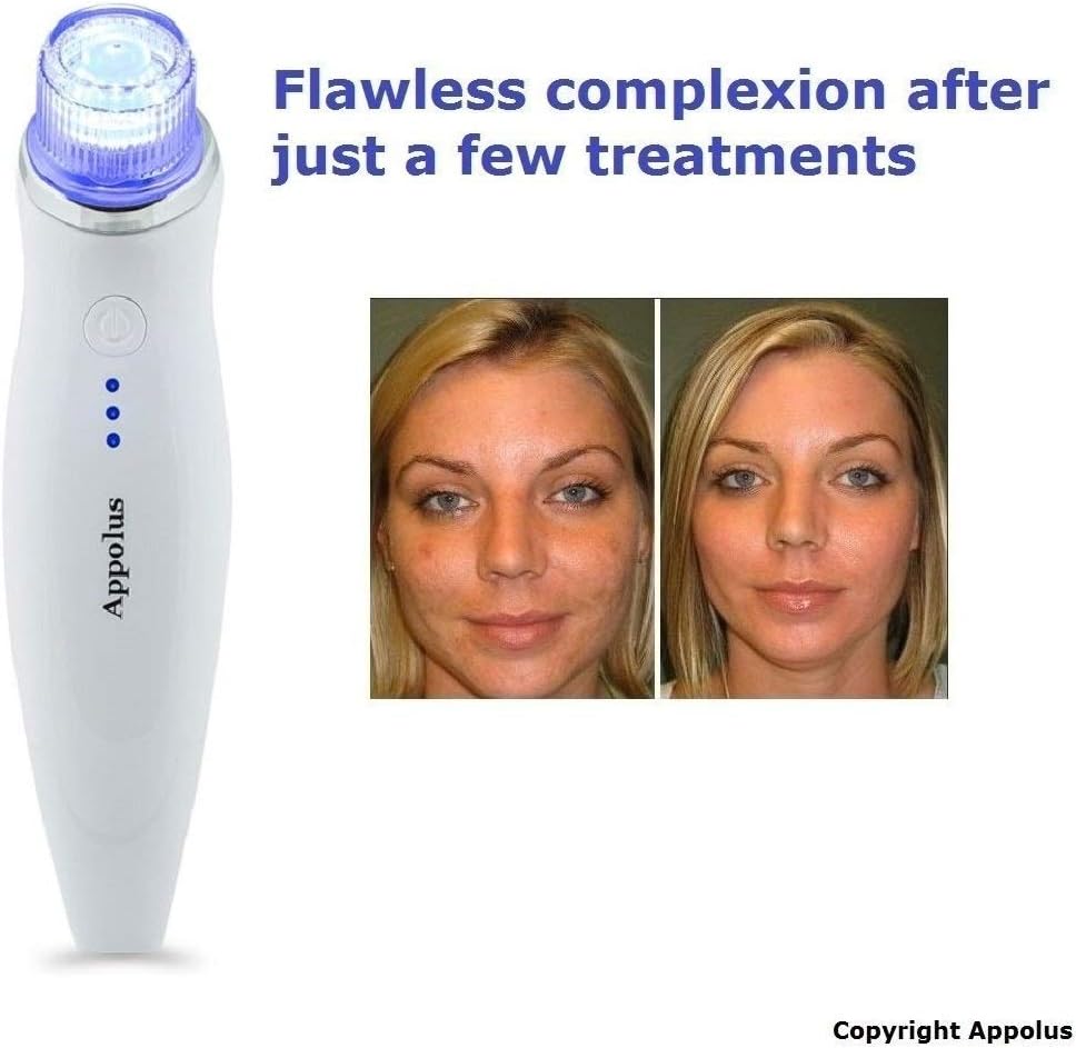 Microdermabrasion Machine - Appolus Premium Diamond Microdermabrasion Device Tool - 2 Diamond Tips - 5 Heads - Blackhead Blemishes Remover - Pores Fine Lines Minimizer