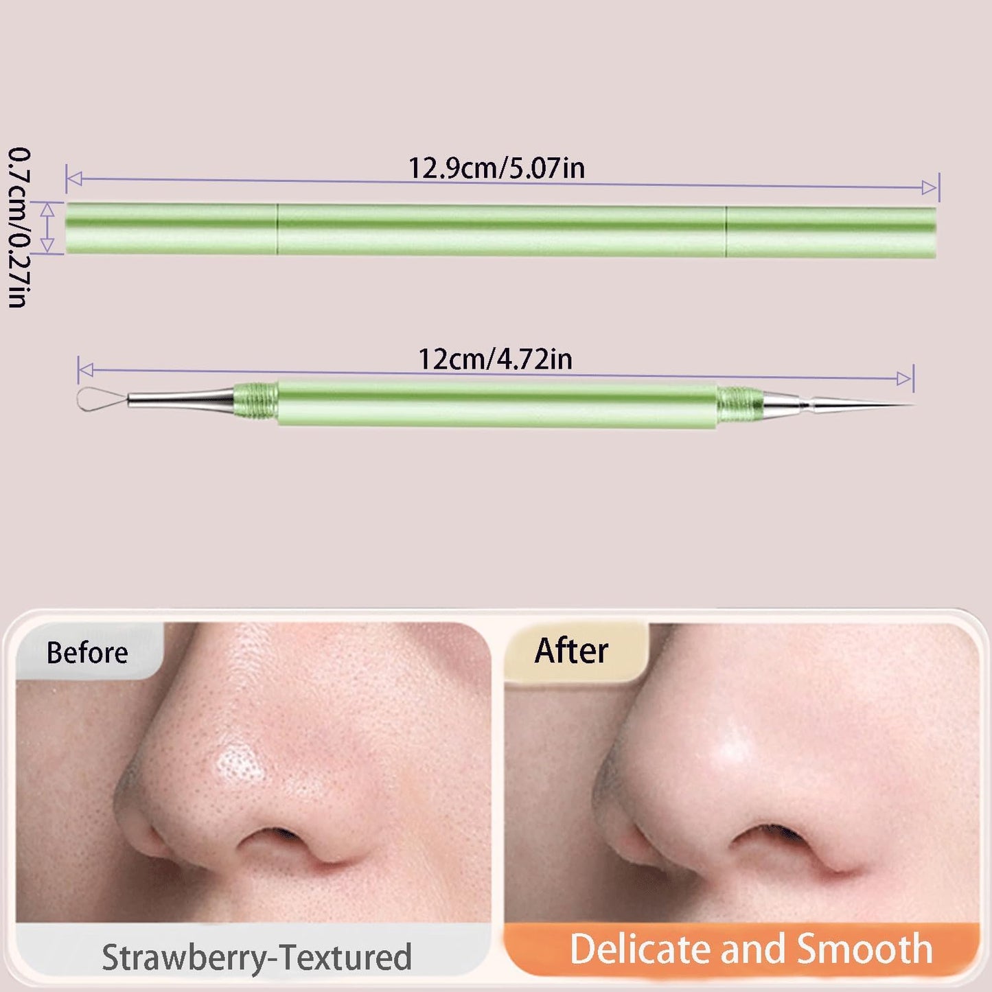 2-in-1 Professional Stainless Steel Acne Removal Needle, Whitehead & Blackhead Remover Tool, Pimples Comedone Extractor Removal Tool, Double Ended Needle with Cap Removal for Nose Face Tools(Green)