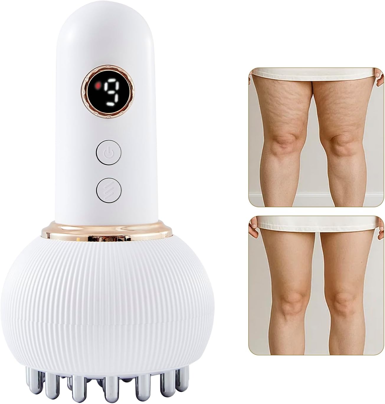 Lymphatic Drainage Massager & Anti Cellulite Massage Tool, Helps Reduce Stretch Marks & Cellulite, for Legs, Arms & Belly, Body Sculpting Machine with Microcurrent, Light, Heat & Vibration