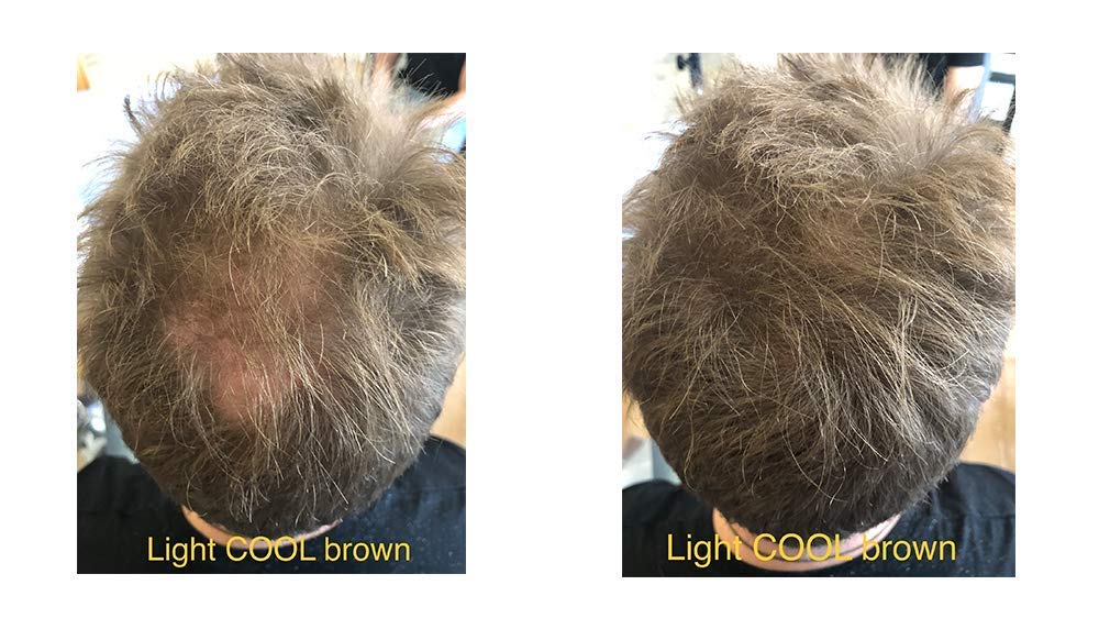 FEBRON Hair Fibers For Thinning Hair For Women & Men Hair Loss Concealer Hair Powder Volumizing Based 100% Undetectable & Natural - Bald Spots Filler (30 Gram, Light COOL Brown)