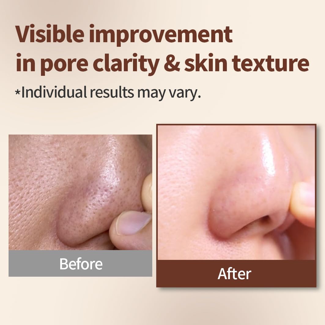 1.618 Korean Clay Mask with Bentonite & Kaolin – Blackhead Remover & Pore Detox Mud for Sensitive, Oily Skin – Deep Cleansing Face Treatment | 4.23 oz