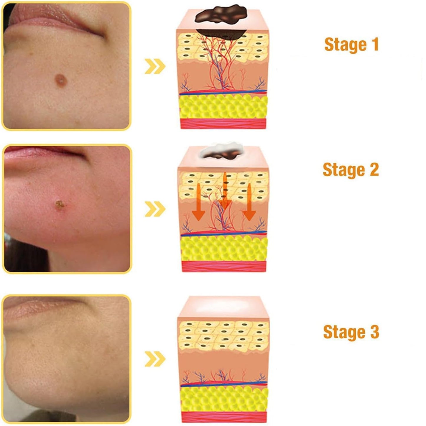 Bee Venom Cream, Professional Bee Venom Cream, Bee Venom Repair Cream for All Parts of The Body (2 Pack)