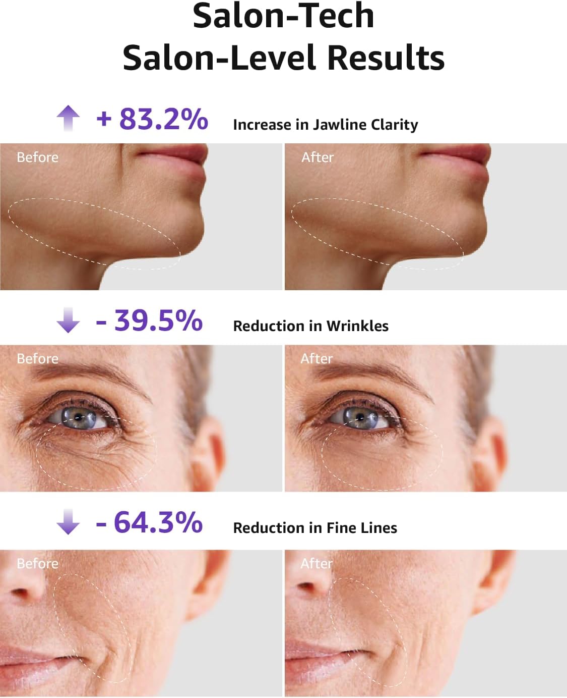 Skin Tightening Face Machine, Facial Massager Light Therapy for Face, 3 in 1 Microcurrent Facial Device Home Use Anti-Aging Device, 5 Level for Facial Firming, Wrinkle, Lifting, Toning, Glow Boost