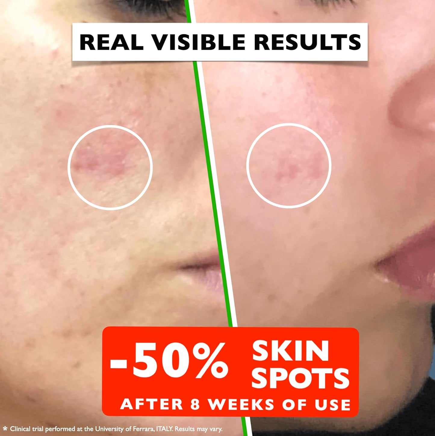 Vitamin C Serum For Face – Anti-Aging Facial Serum with Vitamin C, Hyaluronic Acid, Niacinamide, B5 & Vit E. Brightening Facial Essence for Dark Spots, Fine Lines, Wrinkles & Glowing Skin, 2 Fl Oz