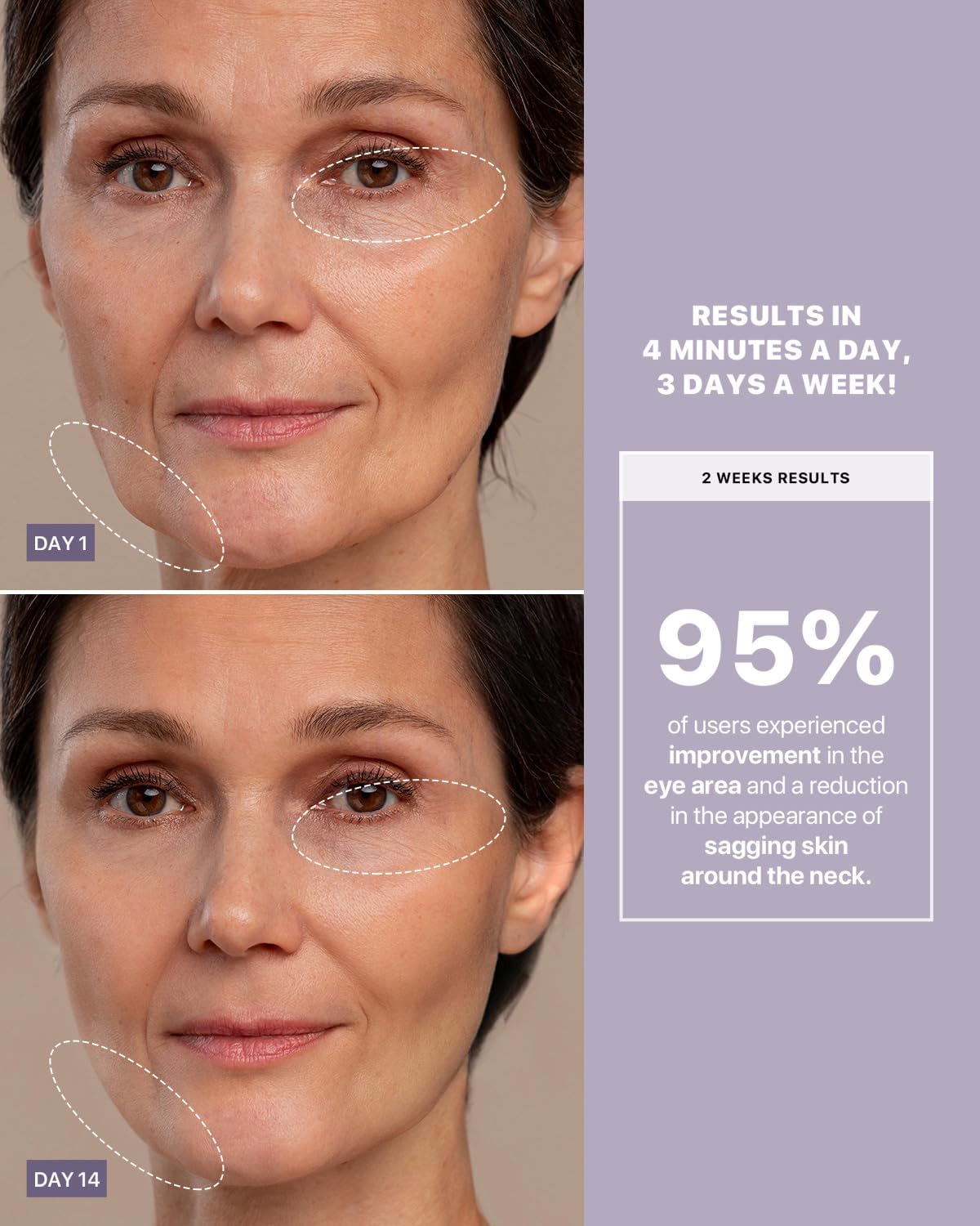 AMIRO R3 Turbo Facial Device, Precision Firming and Fine Line Smoothing Tool for Full Face, Eye Area & Jawline at-Home Therapy Purple