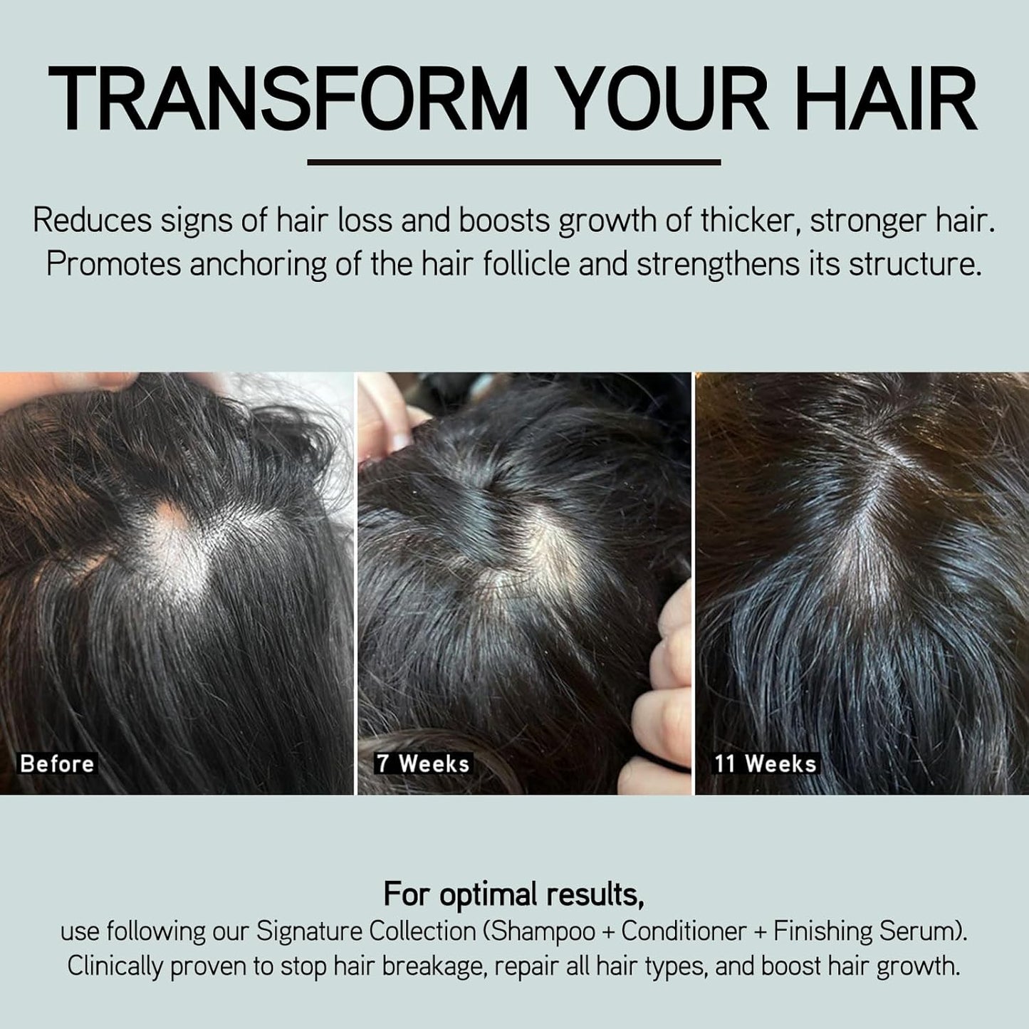 ILES FORMULA Scalp & Hair Rejuvenating Booster – Reduces Hair Loss Signs, Boosts Growth & Thickness, Botanically Derived Breakthrough Blend with Procapil, Tomato, Apple & Wasabi Extracts (1.7 Fl Oz)