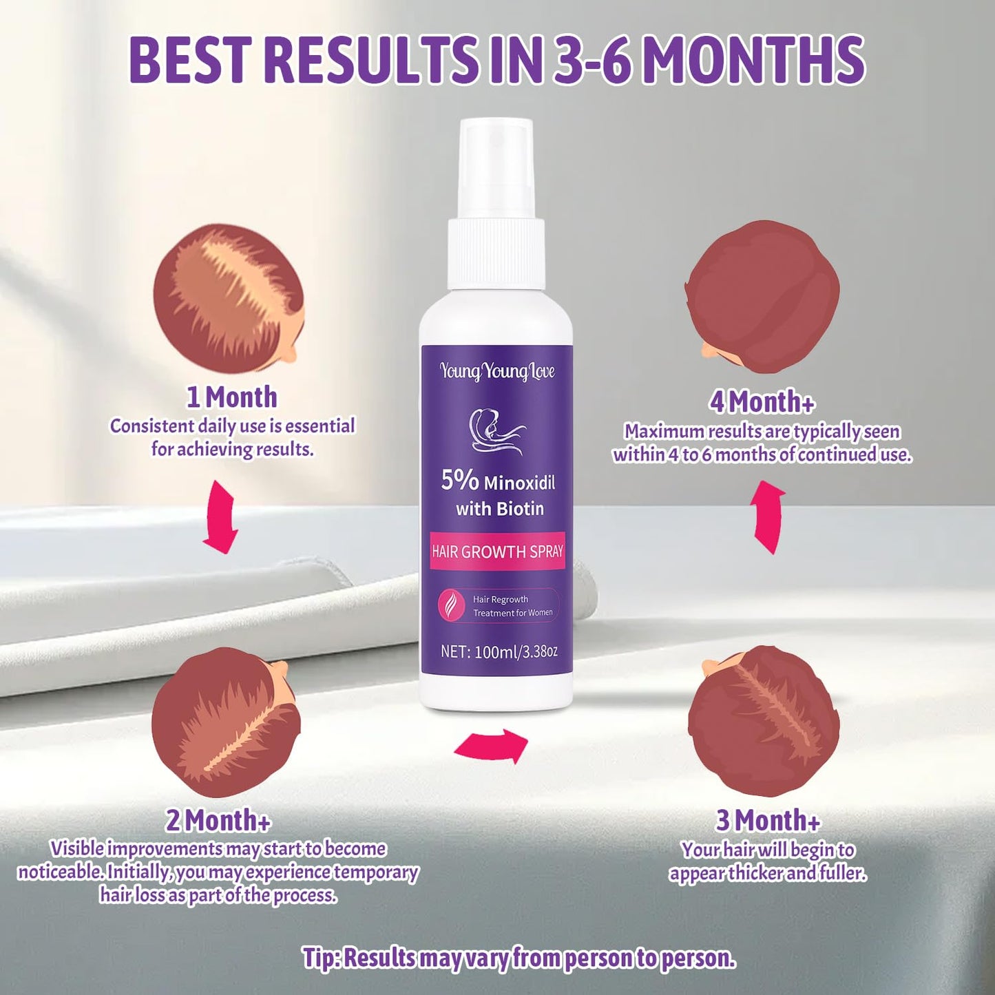 3.38 fl.oz - 5% Minoxidil for Women Hair Growth, Minoxidil Spray with Biotin for Thicker, Stronger, Fuller & Healthier Hair, Hair Regrowth Treatment for Reduce Hair Loss & Thinning, for All Hair Types