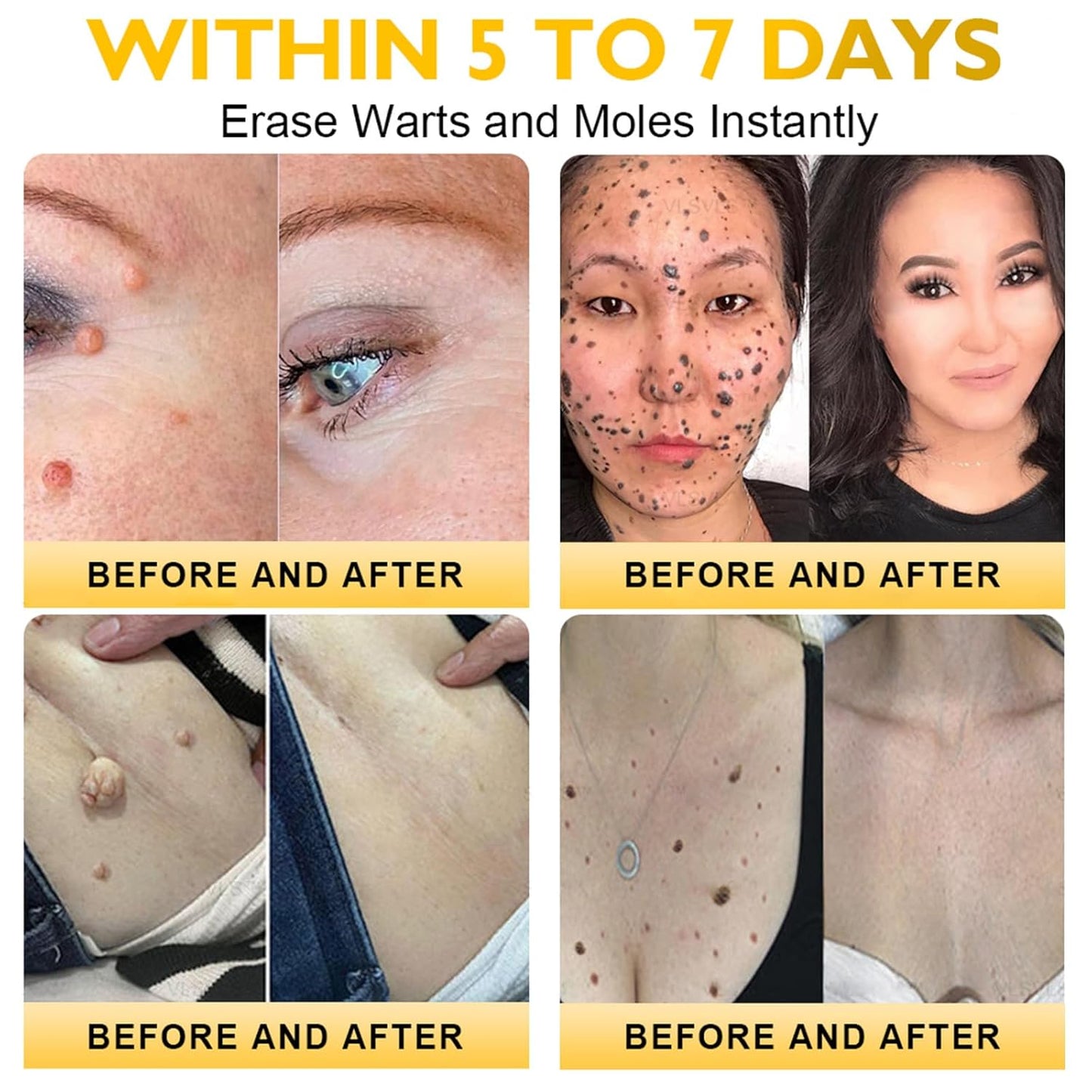 LipMaps Bee Venom skin Restoration Cream,Bee Venom Skin Treatment Cream,Deeply Moisturizing and Firming for All skin Types (4PCS)