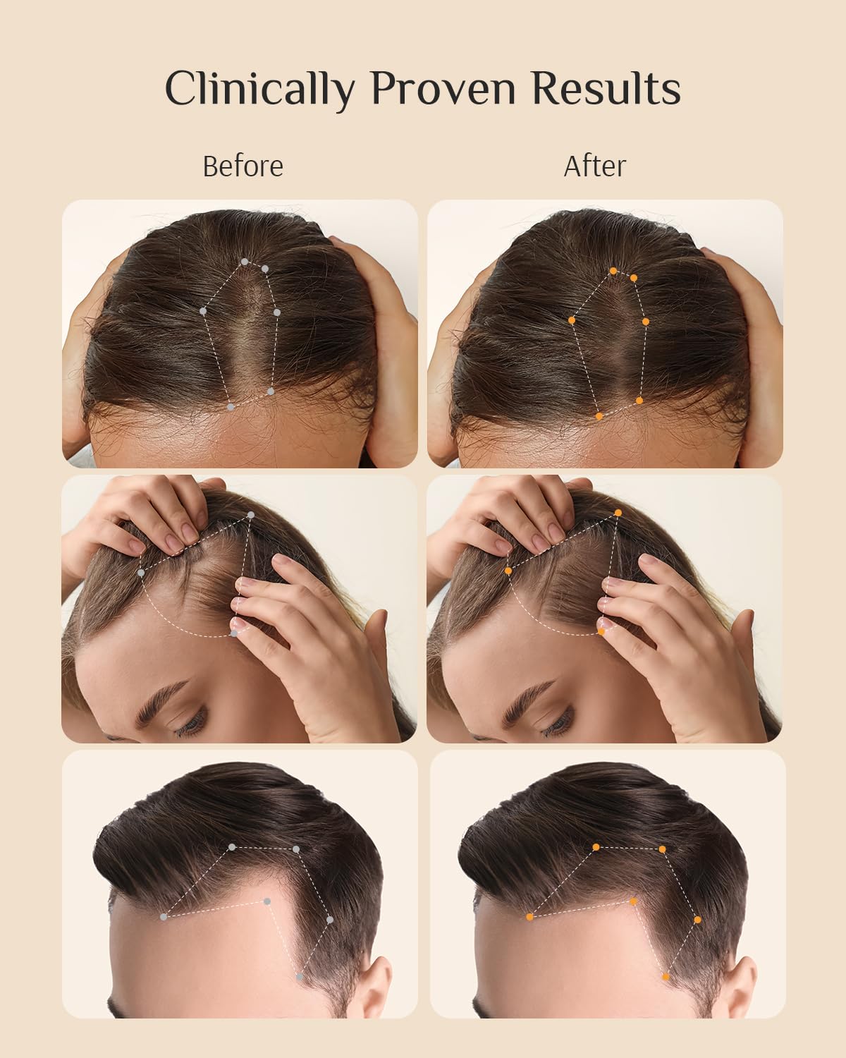 DR ZERO Men's Hair Growth Serum, Japanese Hair Care, Volumizing High-Performance Hair Thickening, with 3% Redensyl® & Nano-Tech Improves Thinning, Sulfate & Silicone-Free, No Side Effects, 2 oz