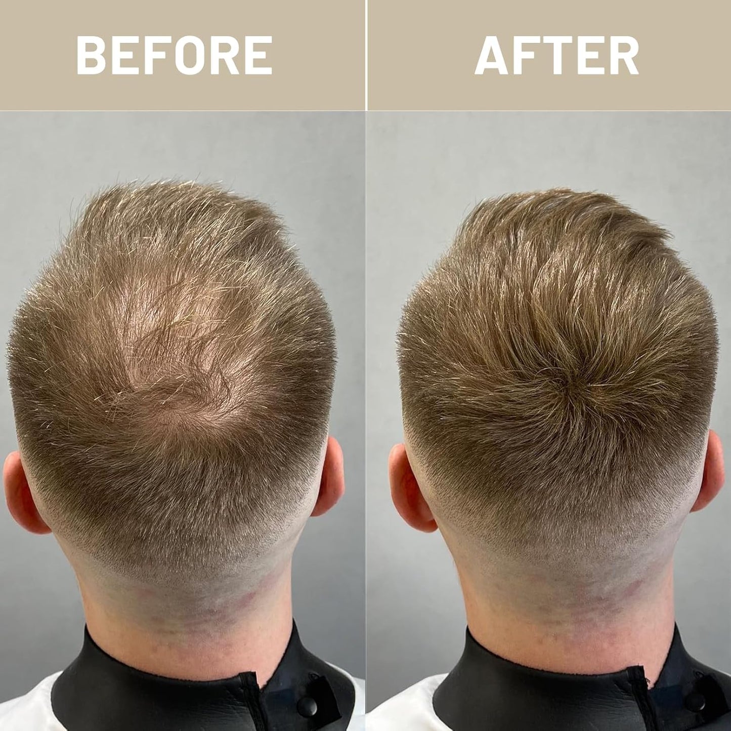 VOLLUCK Hair Fibers for Thinning Hair, Instant Coverage Hair Building Fibers for Women and men, Natural Hair Powder for Conceal Hair Loss 28 g (Black)